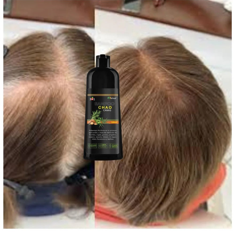 SHAMPOO CHAO CANAS +TRATAMIENTO ACTIVADOR - UNA REVOLUCIÓN EN TU MIRADA